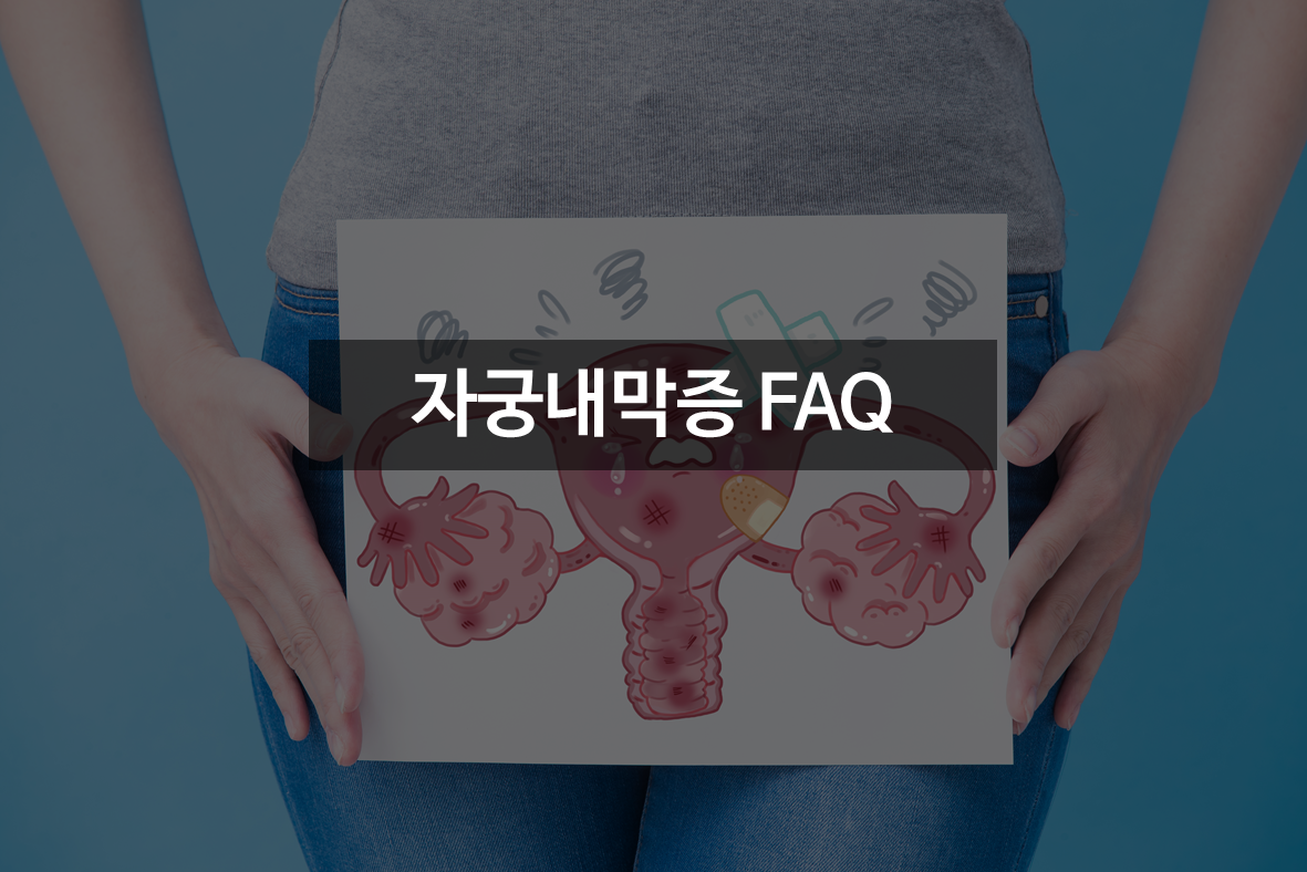 자궁내막증 FAQ! 이것이 궁금해요! 관련이미지
