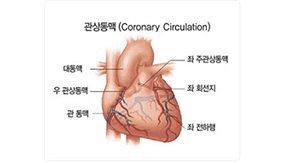 [심장혈관검사] 관상동맥 조영술 관련이미지